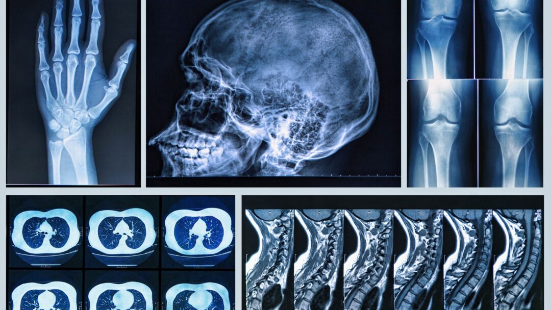 Orthopédie – Traumatologie